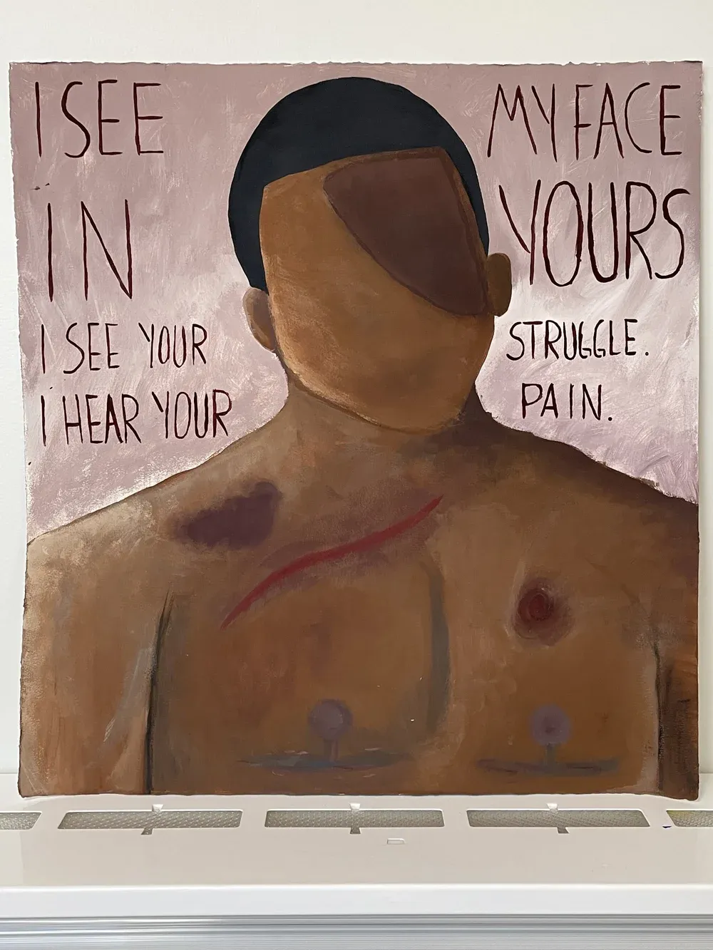 Text I see my face in yours: I see your struggle: I hear your pain surrounding a Black person who is cut and bruised